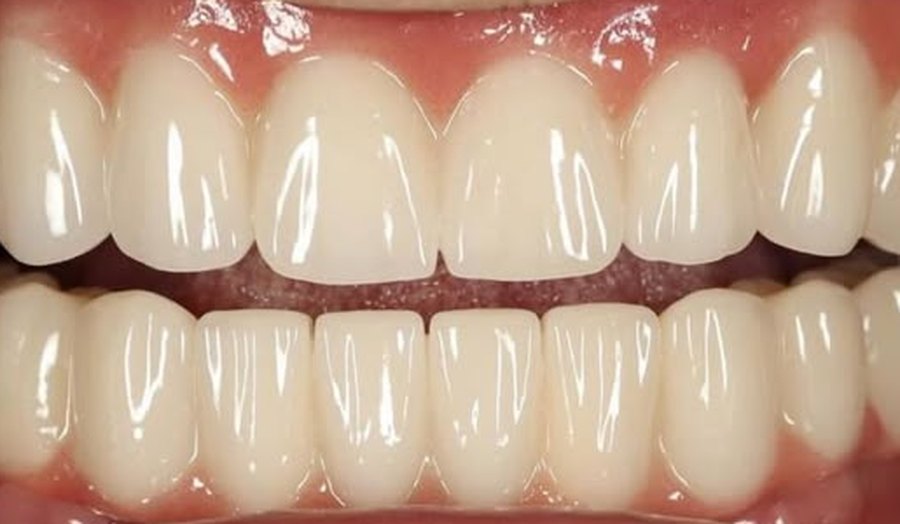 After treatment