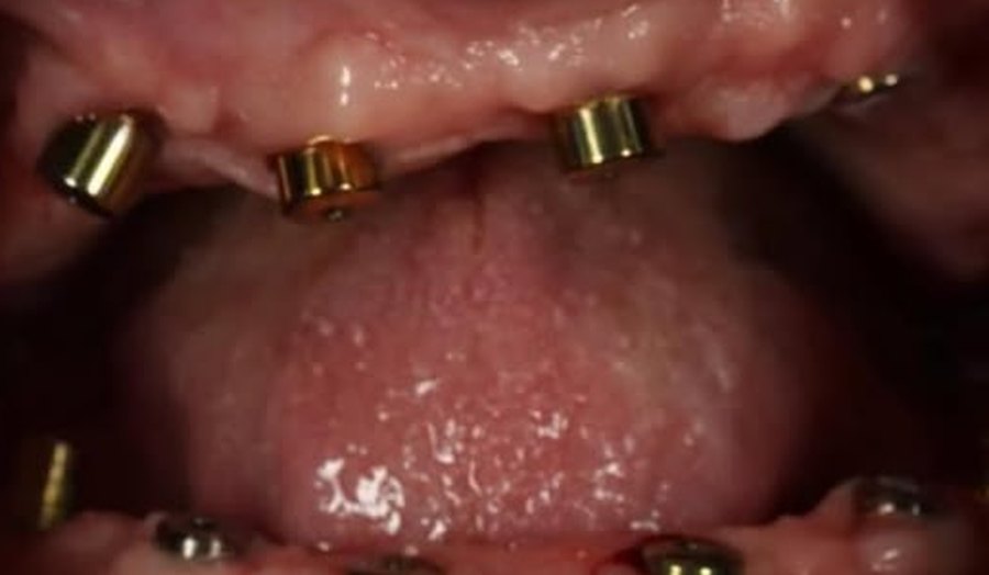 Before treatment